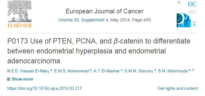 Use of PTEN, PCNA, and β-catenin to differentiate between endometrial hyperplasia and endometrial adenocarcinoma